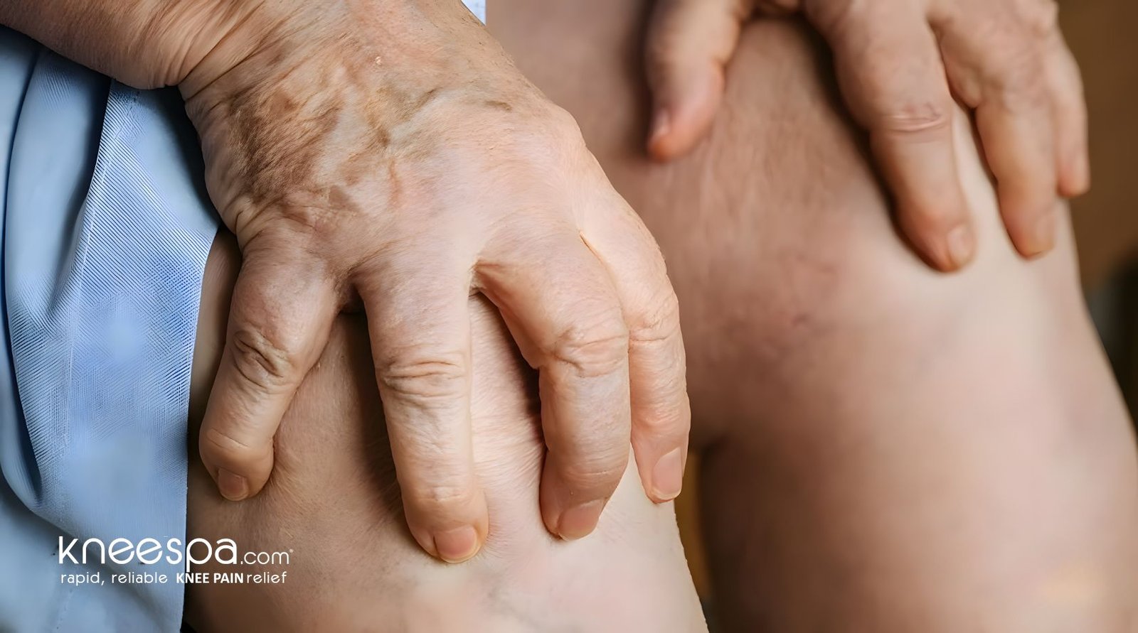 Arthritis