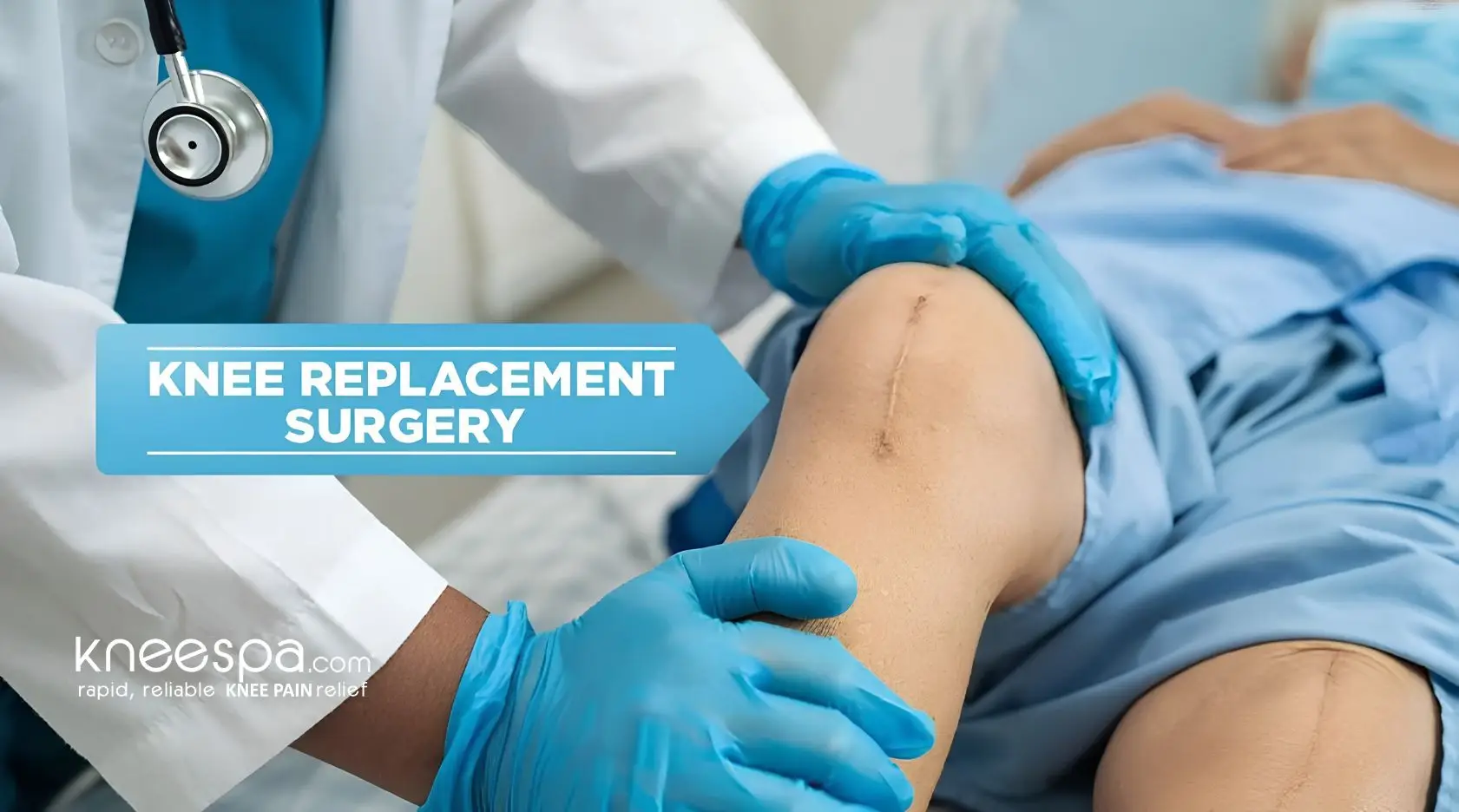 Knee Replacement Surgery