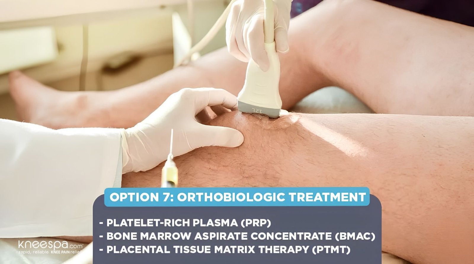 Option 7 Orthobiologic Treatment