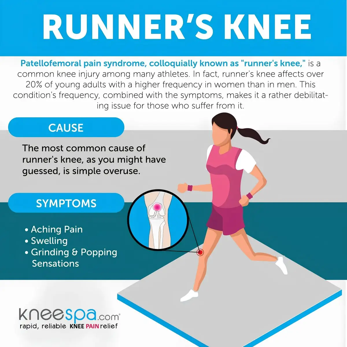 Runner's Knee